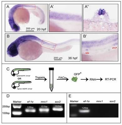 The Requirement of Sox2 for the Spinal Cord Motor Neuron Development of Zebrafish